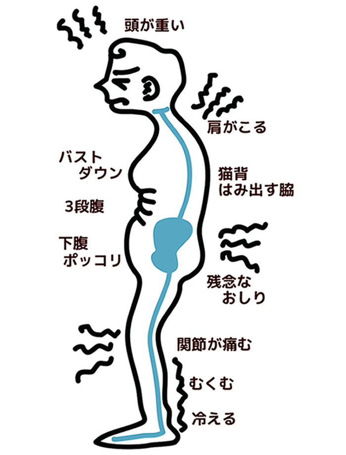 亜脱臼による神経の圧迫